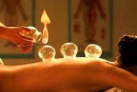 Fire Cupping at Healing Touch Massage Cheyenne Wyoming